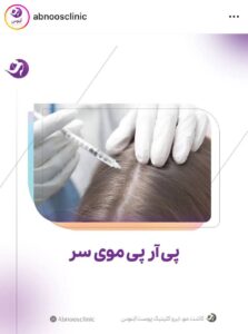 نمونه کار پی آر پی کلینیک آبنوس در مشهد