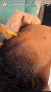 نمونه کار پی آر پی دکتر فریبا صابری در مشهد