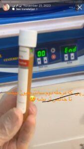 نمونه کار پی آر پی دکتر فریبا صابری در مشهد
