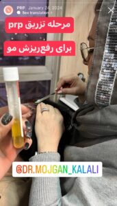 نمونه کار پی آر پی دکتر مژگان کلالی در مشهد