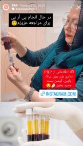 نمونه کار پی آر پی دکتر مژگان کلالی در مشهد