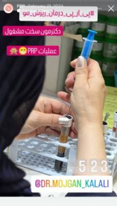 نمونه کار پی آر پی دکتر مژگان کلالی در مشهد