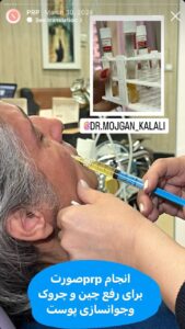 نمونه کار پی آر پی دکتر مژگان کلالی در مشهد