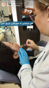 نمونه کار پی آر پی دکتر مژگان کلالی در مشهد