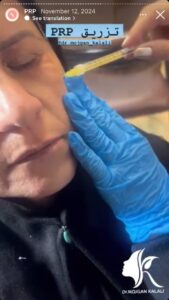 نمونه کار پی آر پی دکتر مژگان کلالی در مشهد
