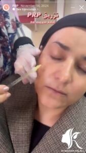 نمونه کار پی آر پی دکتر مژگان کلالی در مشهد