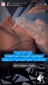 نمونه کار پی آر پی دکتر مژگان کلالی در مشهد