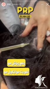 نمونه کار پی آر پی دکتر مژگان کلالی در مشهد