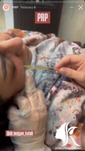 نمونه کار پی آر پی دکتر مژگان کلالی در مشهد