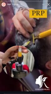 نمونه کار پی آر پی دکتر مژگان کلالی در مشهد