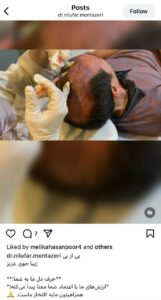 نمونه کار پی آر پی دکتر نیلوفر منتظری هدشی در مشهد