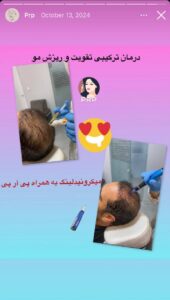 نمونه کار پی آر پی دکتر نیلوفر منتظری هدشی در مشهد