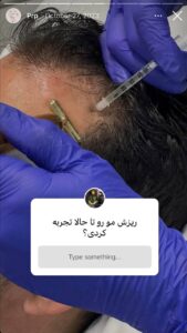 نمونه کار پی آر پی دکتر نیلوفر منتظری هدشی در مشهد