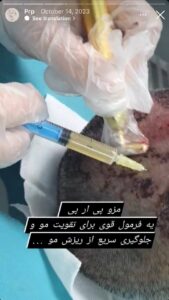 نمونه کار پی آر پی دکتر نیلوفر منتظری هدشی در مشهد
