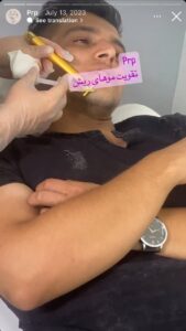 نمونه کار پی آر پی دکتر نیلوفر منتظری هدشی در مشهد