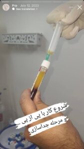 نمونه کار پی آر پی دکتر نیلوفر منتظری هدشی در مشهد