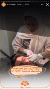 نمونه کار اندولیفت کلینیک سی گل در مشهد