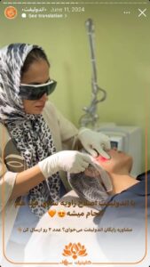 نمونه کار اندولیفت کلینیک سی گل در مشهد