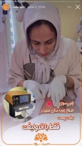 نمونه کار اندولیفت کلینیک سی گل در مشهد