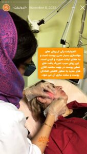 نمونه کار اندولیفت کلینیک سی گل در مشهد