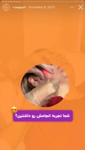 نمونه کار اندولیفت کلینیک سی گل در مشهد