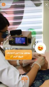 نمونه کار اندولیفت کلینیک سی گل در مشهد