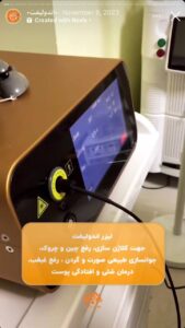 نمونه کار اندولیفت کلینیک سی گل در مشهد