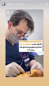 نمونه کار اندولیفت دکتر سلیمان نوری در مشهد
