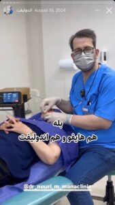 نمونه کار اندولیفت دکتر سلیمان نوری در مشهد