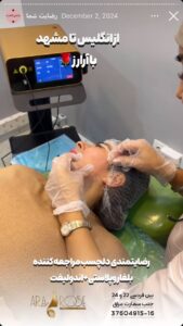 نظرات مراجعه کنندگان اندولیفت کلینیک آرارز در مشهد