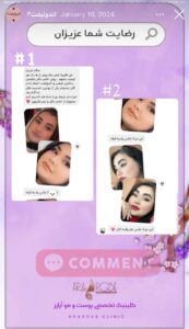 نظرات مراجعه کنندگان اندولیفت کلینیک آرارز در مشهد