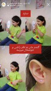 نظرات مراجعه کنندگان پیرسینگ گوش دکتر فرزانه زمانی در مشهد