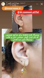 نمونه کار پیرسینگ گوش دکتر فرزانه زمانی در مشهد