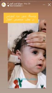 نمونه کار پیرسینگ گوش دکتر فرزانه زمانی در مشهد