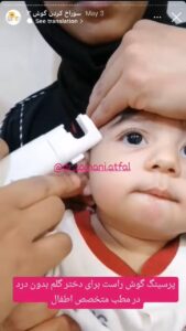 نمونه کار پیرسینگ گوش دکتر فرزانه زمانی در مشهد