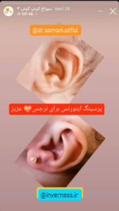 نمونه کار پیرسینگ گوش دکتر فرزانه زمانی در مشهد
