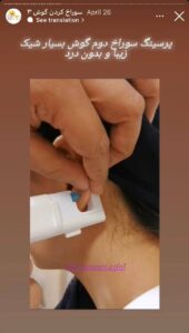 نمونه کار پیرسینگ گوش دکتر فرزانه زمانی در مشهد