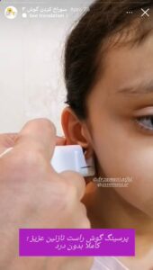 نمونه کار پیرسینگ گوش دکتر فرزانه زمانی در مشهد