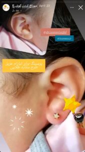 نمونه کار پیرسینگ گوش دکتر فرزانه زمانی در مشهد