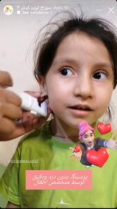 نمونه کار پیرسینگ گوش دکتر فرزانه زمانی در مشهد