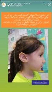 نمونه کار پیرسینگ گوش دکتر فرزانه زمانی در مشهد