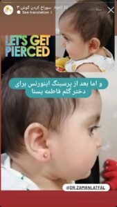 نمونه کار پیرسینگ گوش دکتر فرزانه زمانی در مشهد