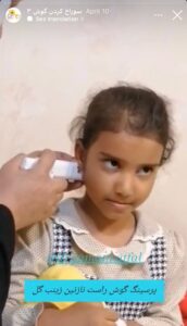نمونه کار پیرسینگ گوش دکتر فرزانه زمانی در مشهد
