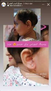 نمونه کار پیرسینگ گوش دکتر فرزانه زمانی در مشهد