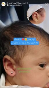 نمونه کار پیرسینگ گوش دکتر فرزانه زمانی در مشهد