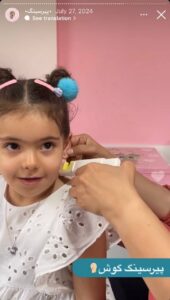 نمونه کار پیرسینگ گوش دکتر تکتم گنجی در مشهد