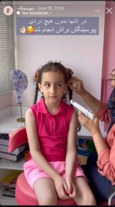نمونه کار پیرسینگ گوش دکتر تکتم گنجی در مشهد