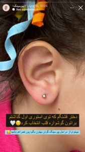 نمونه کار پیرسینگ گوش دکتر تکتم گنجی در مشهد