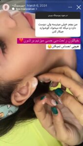 نمونه کار پیرسینگ گوش دکتر تکتم گنجی در مشهد