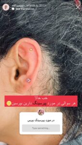 نمونه کار پیرسینگ گوش دکتر تکتم گنجی در مشهد